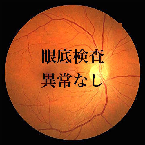 retinopathy test.jpg